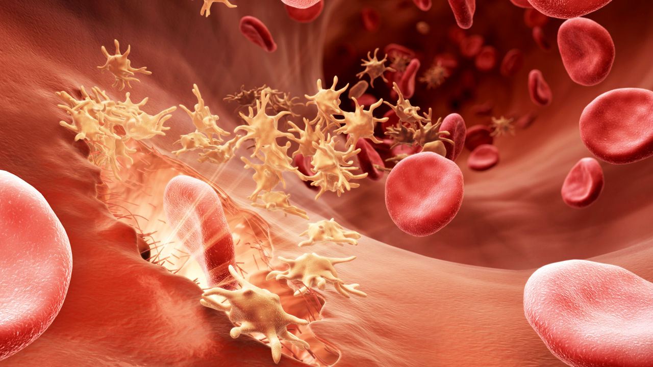 پلاکت خون بالا؛ علت، علائم و روش‌های درمان