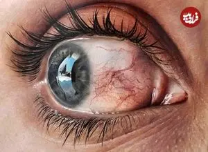 تصاویر؛ نقاشی‌های باورنکردنی و فراواقعی از «چشم» 