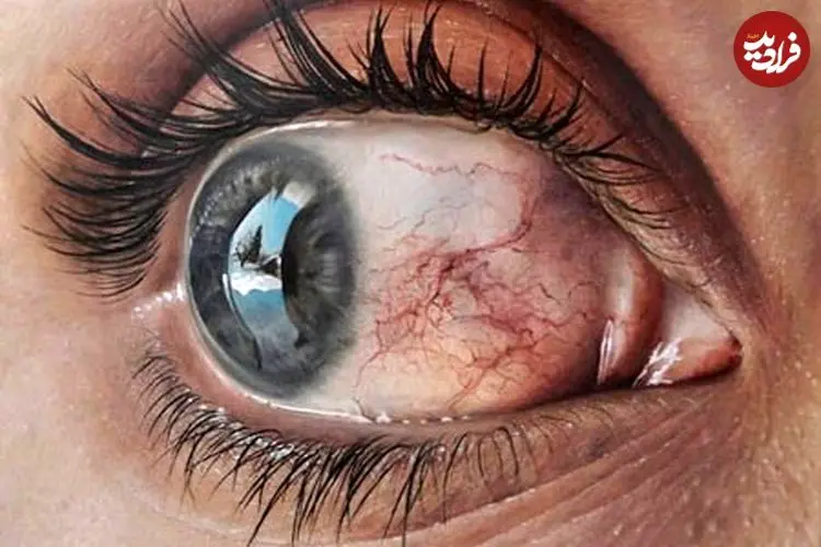 تصاویر؛ نقاشی‌های باورنکردنی و فراواقعی از «چشم» 