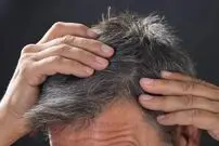 کشف مکانیزم سفید شدنِ موها؛ آیا می‌توان سفیدی موها را معکوس کرد؟