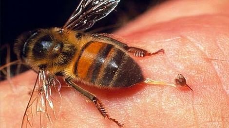 ( ویدیو) دلیل مردن زنبور عسل پس از نیش زدن 