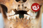 (عکس) وایکینگ‌ها با دندان‌های‌شان چه می‌کردند؟