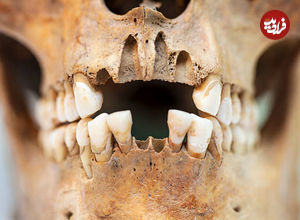 (عکس) وایکینگ‌ها با دندان‌های‌شان چه می‌کردند؟