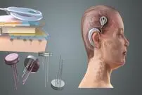 با ایمپلنت‌های مغزی، خصوصی‌ترین افکارتان لو می‌رود!