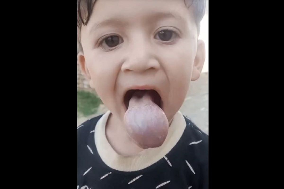 (ویدئو) این پسربچه با بادکردن زبان اش یک شبه مشهور شد!