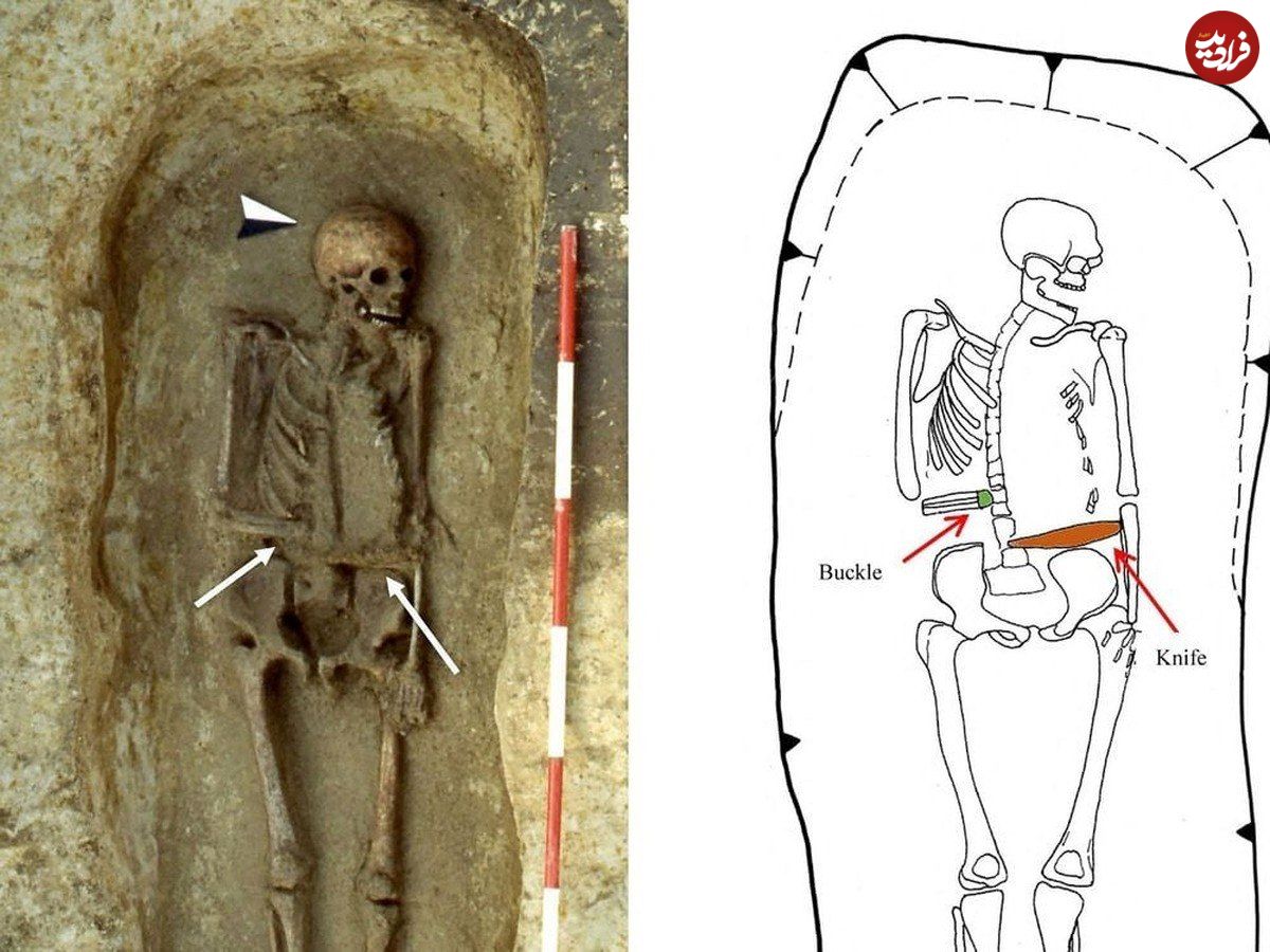 (عکس) کشف اسکلت و اندام مصنوعی در گورستان قرون وسطایی