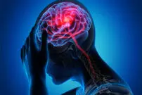 راه‌های مقابله با سکته مغزی را بشناسید