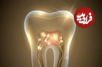 جزئیات کشف داروی رشد مجدد دندان توسط ژاپنی ها