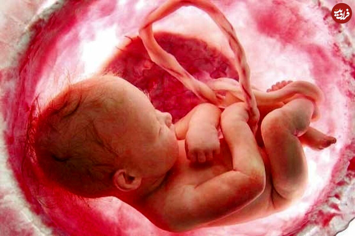 ویدیویی جالب از سکسکه جنین داخل رحم مادر