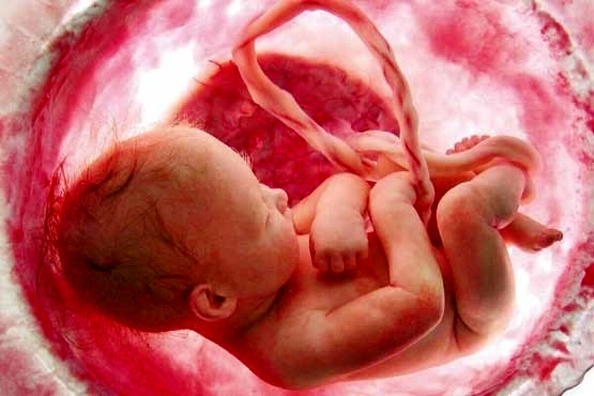ویدیویی جالب از سکسکه جنین داخل رحم مادر