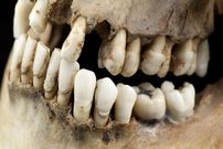 چگونه یک دندان 1600 ساله راز «زن ریاضت‌کش» را فاش کرد؟