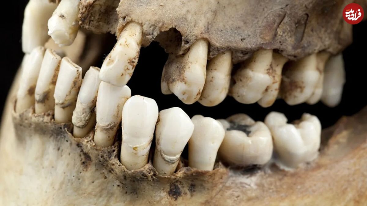 چگونه یک دندان 1600 ساله راز «زن ریاضت‌کش» را فاش کرد؟