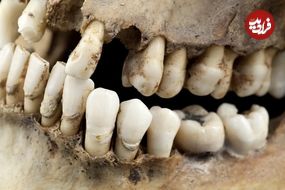 چگونه یک دندان 1600 ساله راز «زن ریاضت‌کش» را فاش کرد؟