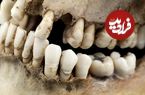 چگونه یک دندان 1600 ساله راز «زن ریاضت‌کش» را فاش کرد؟