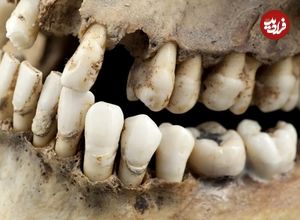 چگونه یک دندان 1600 ساله راز «زن ریاضت‌کش» را فاش کرد؟