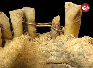 کشف «سیم‌کشی طلایی دندان» در گورستان 500 ساله