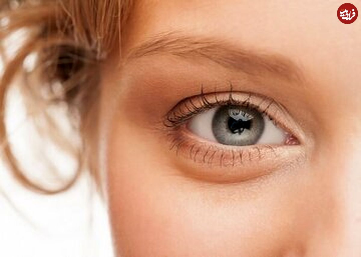 ۱۰ عادت مهم که سلامت چشمانتان را تضمین می‌کند