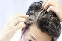 کمبود این ویتامین سبب سفیدی مو می‌شود