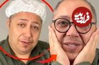 ببینید؛ مازیار لرستانی: «برای عمل غبغب مجبور شدم ریش‌هایم را بزنم»