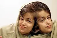عکس| سفر زمان؛ «لاله و لادن» در 29 سالگی و پیش از جراحی در سنگاپور؛ سال 82