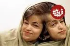 عکس| سفر زمان؛ «لاله و لادن» در 29 سالگی و پیش از جراحی در سنگاپور؛ سال 82