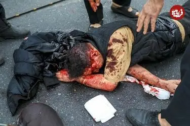 تصاویر دلخراش از حمله موشکی به اتوبان شهید باقری تهران