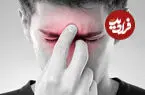 آلودگی هوا چگونه موجب تشدید سینوزیت مزمن می‌شود؟