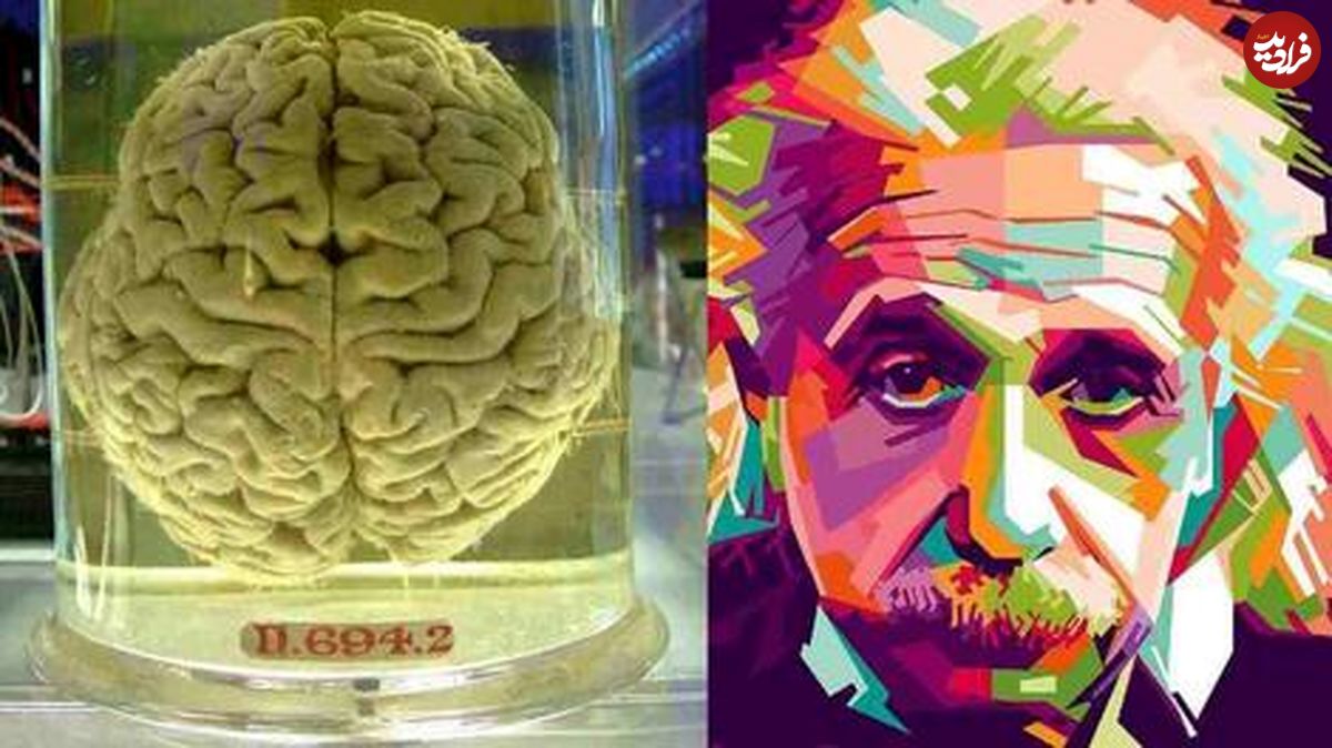 مغز آلبرت اینشتین در شیشه؛چه تفاوتی با مغز دیگران مشاهده شد؟