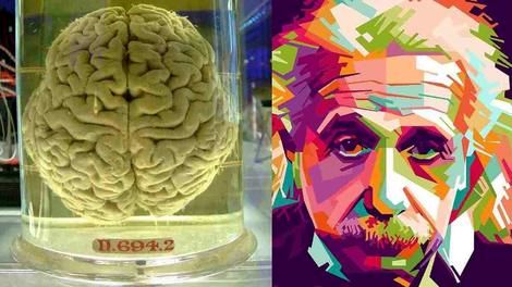 مغز آلبرت اینشتین در شیشه؛چه تفاوتی با مغز دیگران مشاهده شد؟