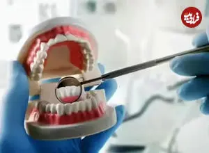 این شیوه مسواک زدن دندان‌هایتان را خراب می‌کند/ راهکارهای درست مسواک زدن