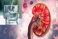 چرا نوشیدن آب برای جلوگیری از سنگ کلیه کافی نیست؟