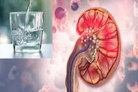 چرا نوشیدن آب برای جلوگیری از سنگ کلیه کافی نیست؟
