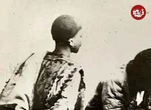 عکس| سفر به ایران قدیم؛ صحنۀ «کشیدن دندان» در ایران دوران قاجار
