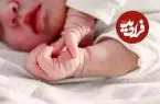 عکس؛ این نوزاد با چیزی غیرعادی به دنیا آمد!
