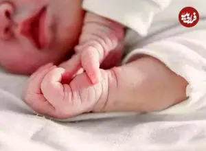 عکس؛ این نوزاد با چیزی غیرعادی به دنیا آمد!