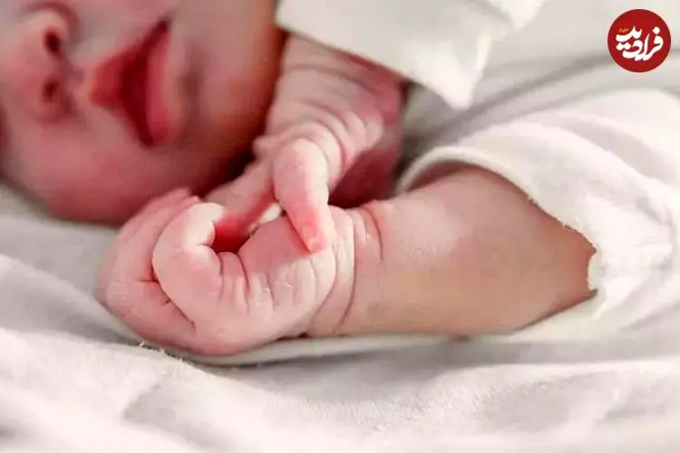 عکس؛ این نوزاد با چیزی غیرعادی به دنیا آمد!