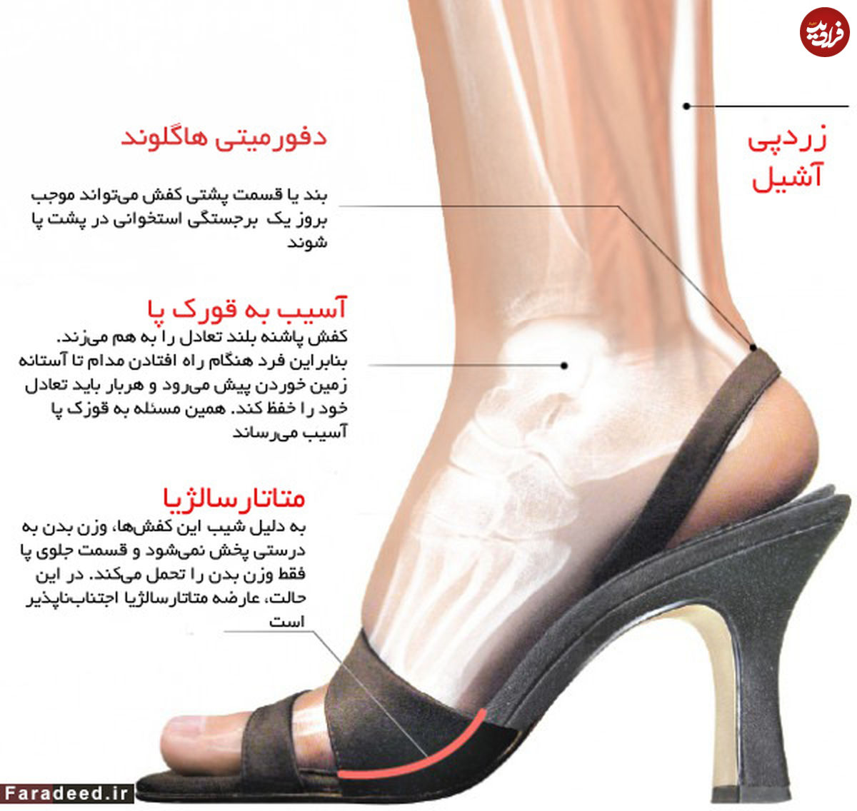 کفش پاشنه بلند؛ به چه قیمتی؟