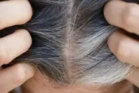 کشف راهی برای جلوگیری از سفید شدن مو‌ها