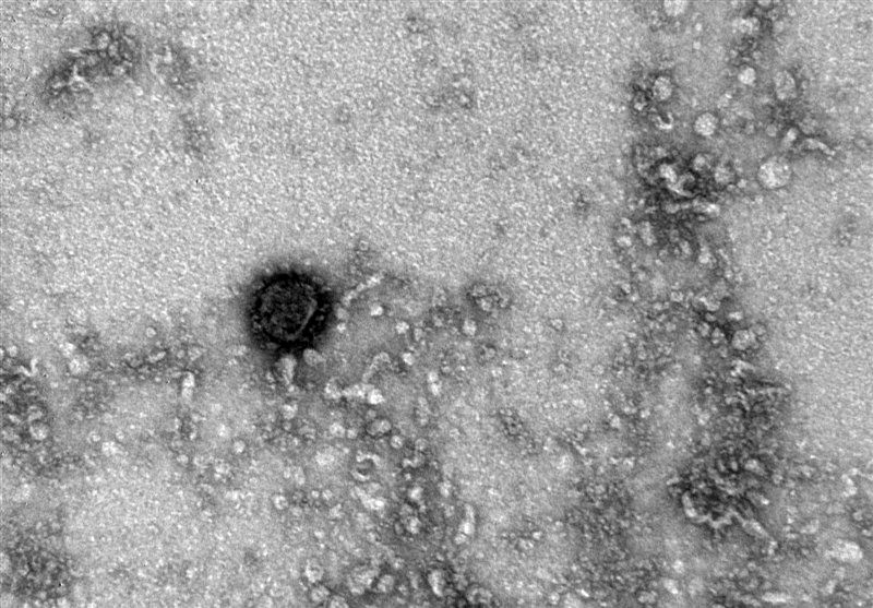 تصاویر جدید از ویروس کرونا پس از کشف دانشمندان روسی