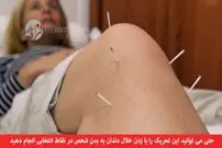 آیا طب سوزنی واقعا شفابخش است؟
