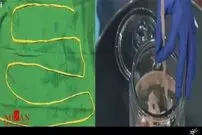 تصاویر/ خارج کردن کرم دو متری از شکم مرد هندی