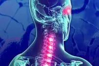 بیماری ام‌اس چگونه به وجود می‌آید؟
