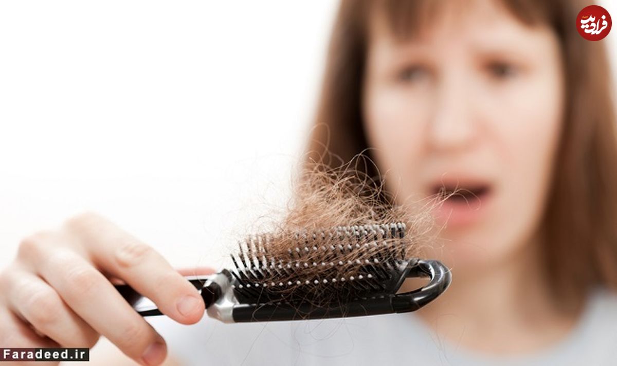درمان ریزش مو؛ ۱۱ روش جادویی برای توقف ریزش مو