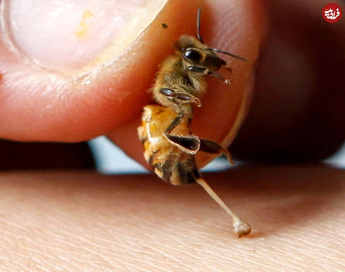 از بین بردن سلول‌های سرطانی با زهر زنبور عسل