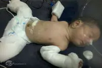 تصاویر/ تولد نوزاد باردار در هند!