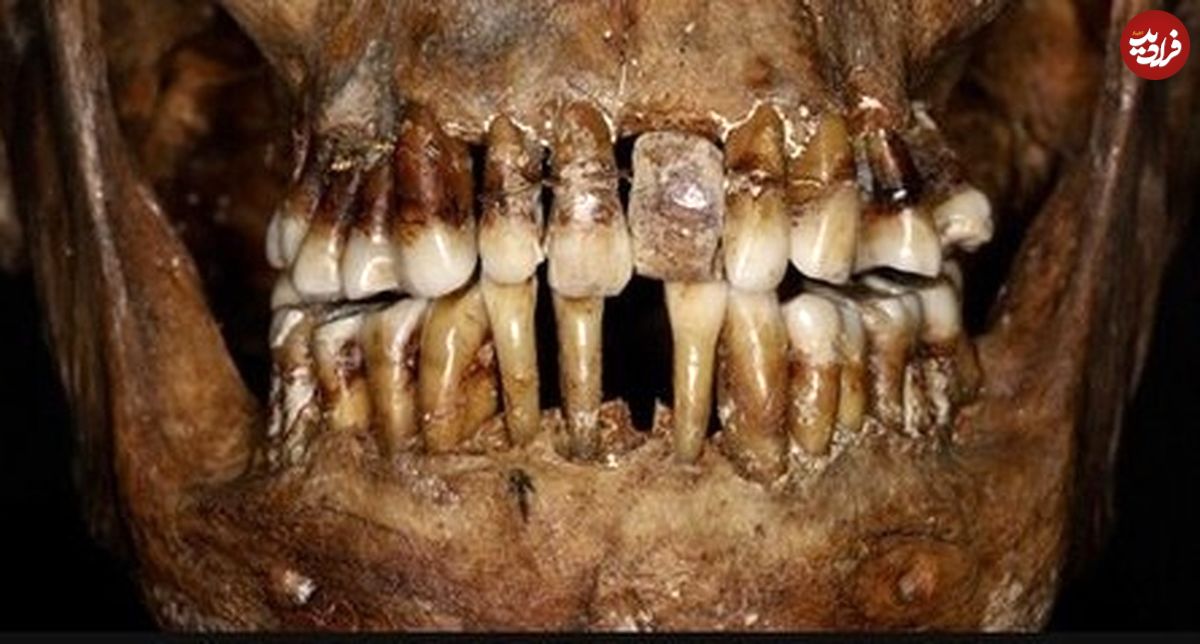 (عکس) افشای راز دردناک زن اشرافزاده پس از ۴ قرن