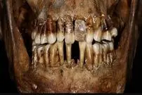 (عکس) افشای راز دردناک زن اشراف‌زاده پس از ۴ قرن