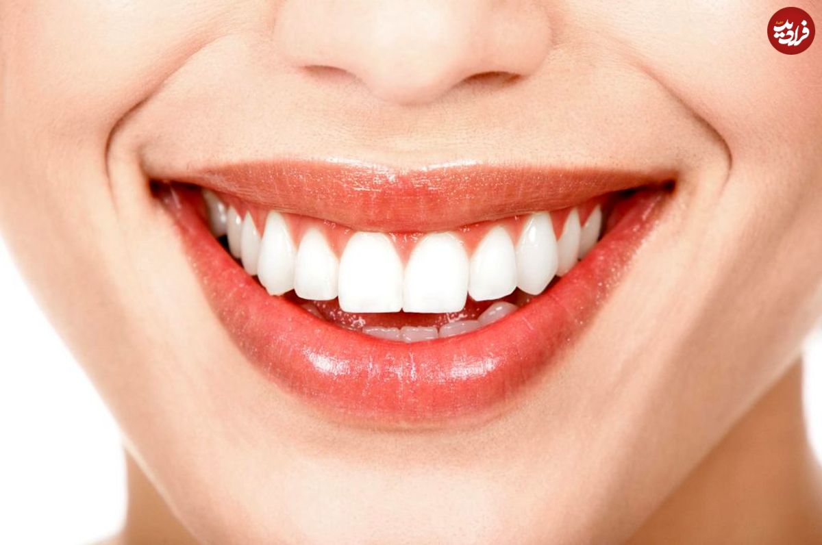 قوی‌ترین سفیدکننده خانگی دندان