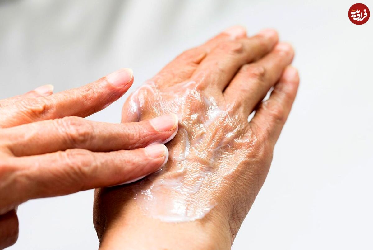 ۳ درمان خانگی و موثر برای رفع خشکی دست