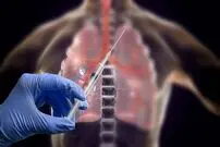 ببینید؛ محققان ایرانی واکسن سرطان ریه را ساختند